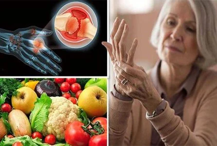 آرتروز 6 مادهی غذایی مضر برای افراد مبتلا به آرتروز