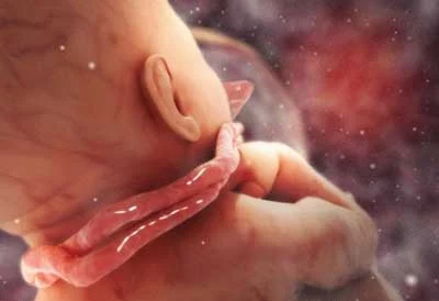 سکسکه جنین چیست و چگونه احساس می شود؟