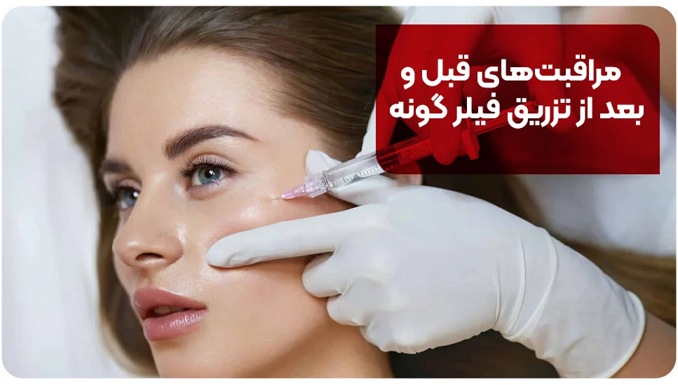 مراقبت‌های قبل و بعد از تزریق فیلر گونه