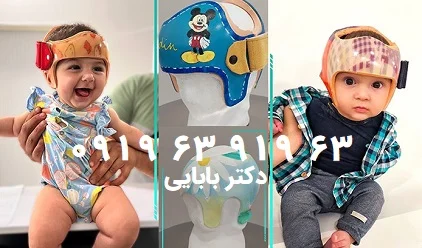 مدت زمان شکل گیری فرم سر نوزاد